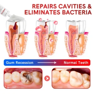 SP-6 Probiotic Ultra Whitening Toothpaste - Image 6