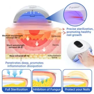 Advanced PureNail Fungus Laser Device - Image 2