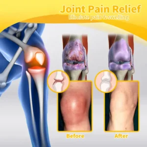 Bee Venom Joint and Bone Cream - Image 8