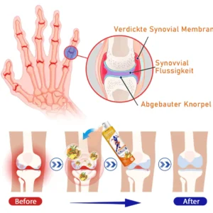 Turmeric Arthritis Spray - Image 8