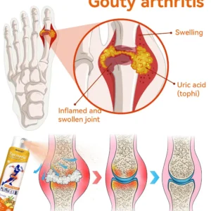 Turmeric Arthritis Spray - Image 9
