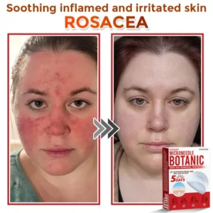 MicroNeedle Botanic Skin Tag Removal Patch - Image 5