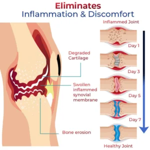 JointMax Discomfort and Inflammation Relief Foam - Image 2