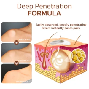 Lumpless Lipoma Treatment Cream - Image 3