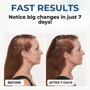Hair Regrowth Capsules - Image 2