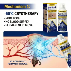 WartLock Cryo-Recovery Cooling Spray - Image 5