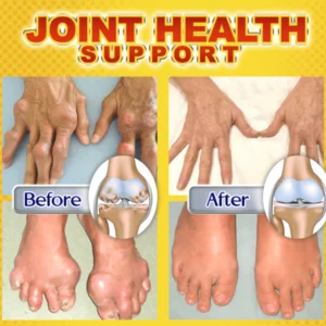 Joint & Bone Therapy Bee Venom Treatment Gel - Image 2