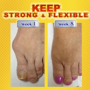 Joint & Bone Therapy Bee Venom Treatment Gel - Image 4