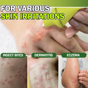 Intensive Eczema Relief Cream - Image 3