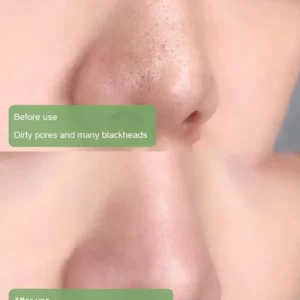100% Natural Green Tea Deep Cleanse Mask - Image 5