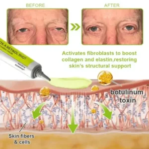 Botox Vitamin A Retinol Anti-Wrinkle Firming and Lifting Cream Last Day for Limited Time 70 OFF - Image 25