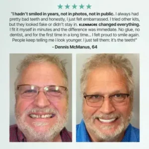 Custom-Fit Fully Functional Dentures - Image 11