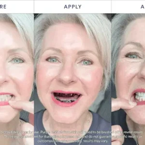Purple Teeth Whitening Strips - Image 9