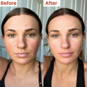 Cheilitis Cream - Image 10