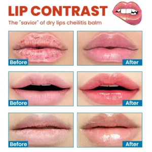 Cheilitis Cream - Image 12