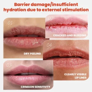 Cheilitis Cream - Image 8
