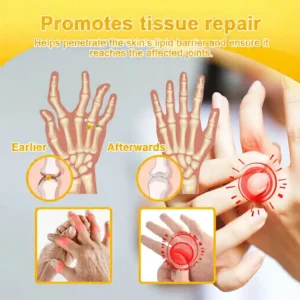 Bee Venom Pain-Relief Bone Healing Cream - Image 12