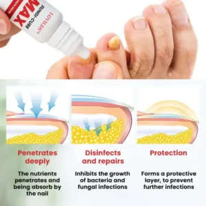 Fungi-Cure Max Fast-Acting Relief for Fungal Nail Infections - Image 5