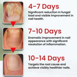 LOVILDS Fungi-Cure Max Triple-Action Formula - Image 4