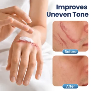 Texture Repair Gel - Image 3