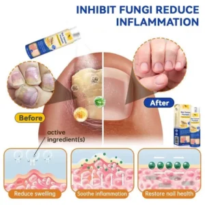 PsoriaHeal Bee Venom Psoriasis Treatment Spray - Image 9