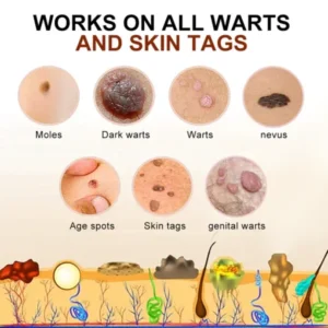 Bee Venom Mole and Wart Treatment Cream - Image 5