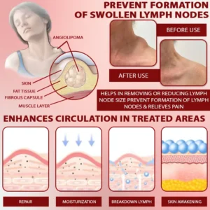 Horse Chestnut SwellAway Massage Gel - Image 7