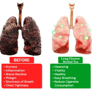 MULLEIN Natural Herbal Tea For Lung Cleanse And Respiratory Support - Image 8