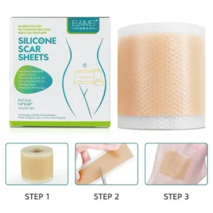 Medical Soft Silicone Gel Tape for Scar Removal (1.6” x 60”） - Image 2