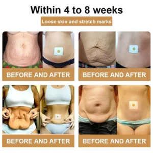𝐁𝐞𝐞 𝐕𝐞𝐧𝐨𝐦 𝐋𝐲𝐦𝐩𝐡𝐚𝐭𝐢𝐜 𝐃𝐫𝐚𝐢𝐧𝐚𝐠𝐞 𝐒𝐥𝐢𝐦𝐦𝐢𝐧𝐠 𝐏𝐚𝐭𝐜𝐡 - Image 10
