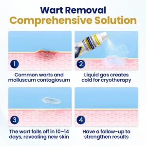 ChillErase Bump Renewal Spray - Image 6