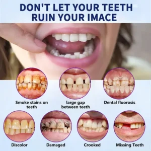 Advanced Customized Full Denture Set - Image 2
