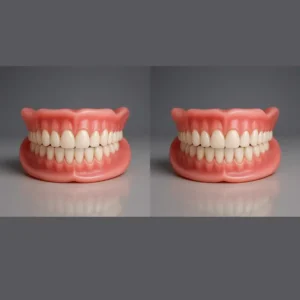 Custom-Fit Functional Dentures - Perfectly Fitted in Minutes at Home - Image 14