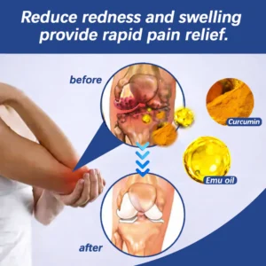 Turmeric + Emu Oil Arthritis Relief Massage Gel - Image 3