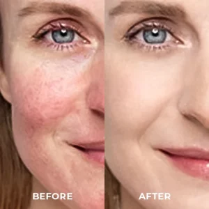 Placenta Dragon's Blood Brightening Cream - Image 8