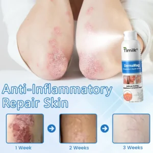 DermaMag Magnesium Repair Spray - Image 7