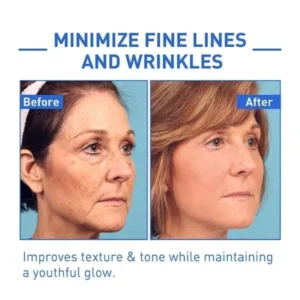 Oveallgo ™ Youthfully Botox Face Serum - Image 3
