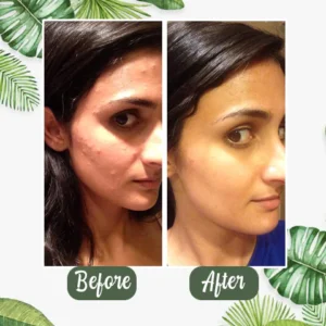 Poreless Deep Cleanse Green Tea plant cleaning paste - Image 2