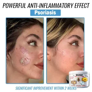 Bee Venom Multi-Symptom Treatment Cream - Image 2