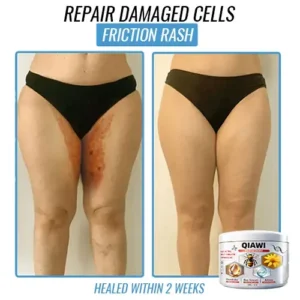 Bee Venom Multi-Symptom Treatment Cream - Image 7