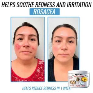Bee Venom Multi-Symptom Treatment Cream - Image 8