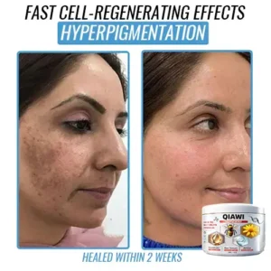 Bee Venom Multi-Symptom Treatment Cream - Image 9