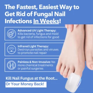 - Nail Fungus Laser Device - Image 4