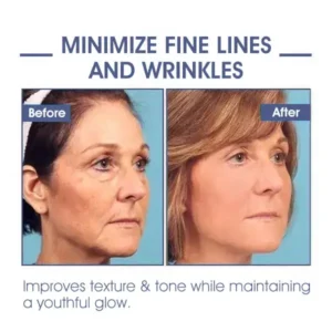 𝐀𝐝𝐯𝐚𝐧𝐜𝐞𝐝 𝐅𝐢𝐫𝐦𝐢𝐧𝐠 & 𝐖𝐫𝐢𝐧𝐤𝐥𝐞-𝐑𝐞𝐝𝐮𝐜𝐢𝐧𝐠 𝐂𝐫𝐞𝐚𝐦 Pro - Image 12