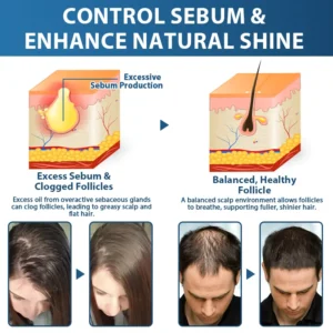 STEM Cell Hair Cycle Roller - Image 5