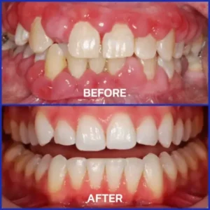 VioCore Bee Venom Dental Treatment Toothpaste - Image 10