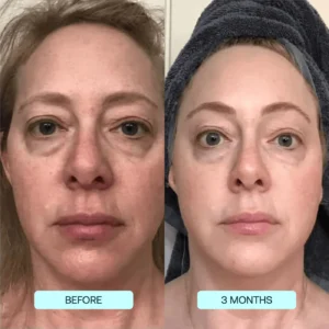 Hyaluronic Acid Niacinamide Hydrating Mask - Image 6