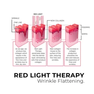 EMS Red Light Face Treatment - Image 4