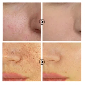Skin Brightening Anti-Aging Oil Control Anti-Spot Serum - Image 3