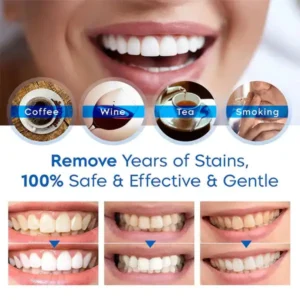 Teeth Whitening Essence - Image 4